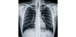 x-ray