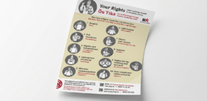 your rights
